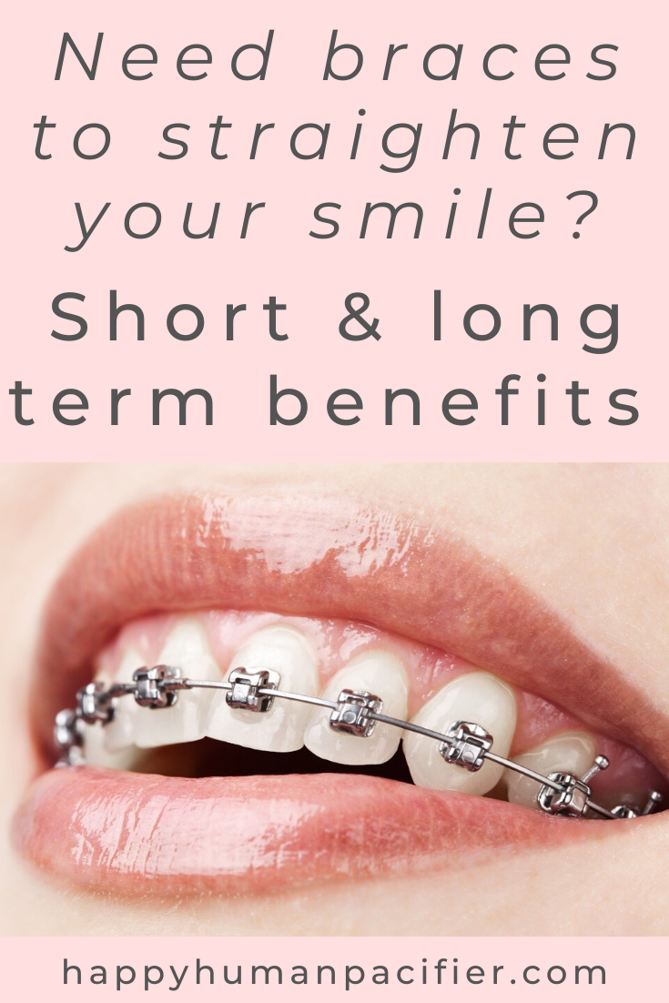 Oh, dear... Just left a dental check-up and been told you need braces? Here are the short and long term benefits of realigning your teeth with braces. #benefitsofbraces #dentalcare #selfcare