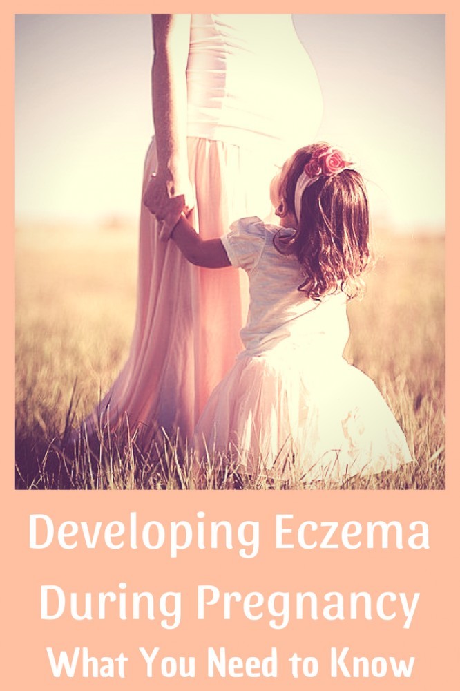 Are you looking for natural ways to treat eczema while pregnant? Then pop over to happyhumanpacifier.com #treateczemawhilepregnant