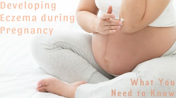 Treat Eczema While Pregnant happyhumanpacifier.com