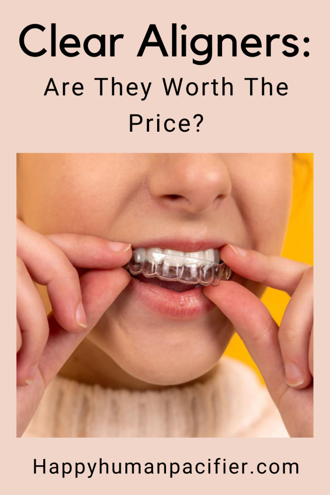 are clear aligners worth the price