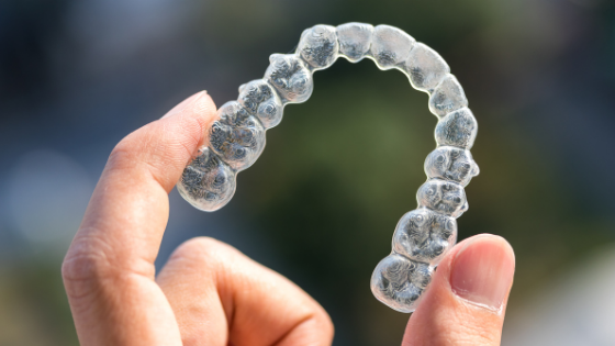 Clear Aligners: Are They Worth the Price? | invisalign 1