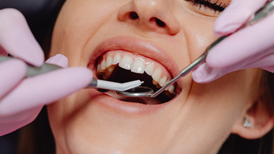 Surprising Services Available at the Dentist | 72890e3dbb7f608d5cc4571a511c8214 cropped optimized