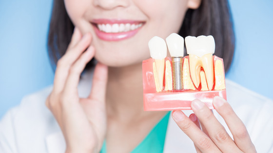 4 Best Benefits of Oral Implants Worth Knowing | 82c607ee6e5e831ba17ae70fb849fa4e cropped optimized