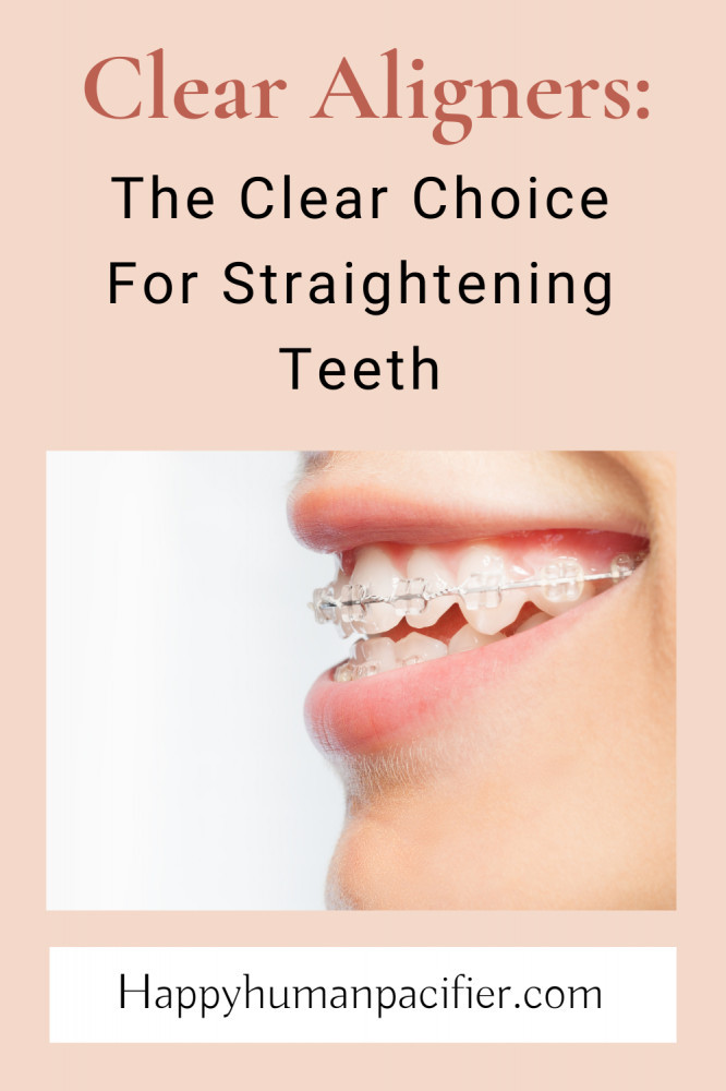 clear aligners for teeth straightening