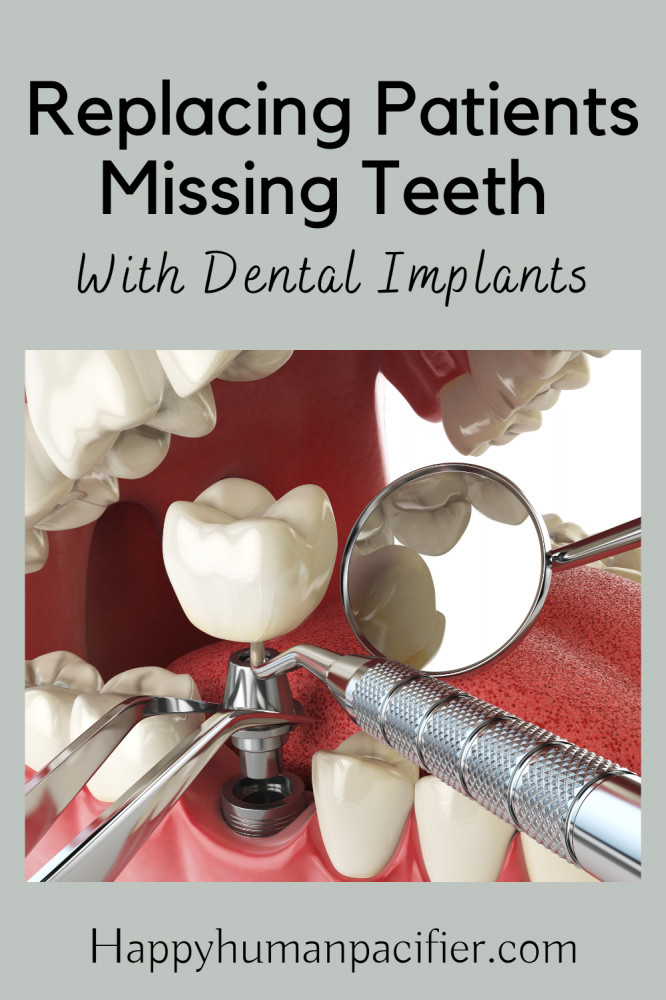 replacing patients missing teeth